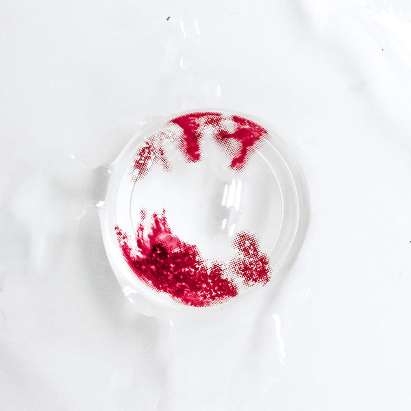 Princess Pinky Vessel Burst Sclera