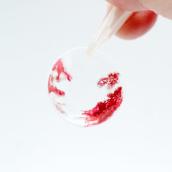 Princess Pinky Vessel Burst Sclera